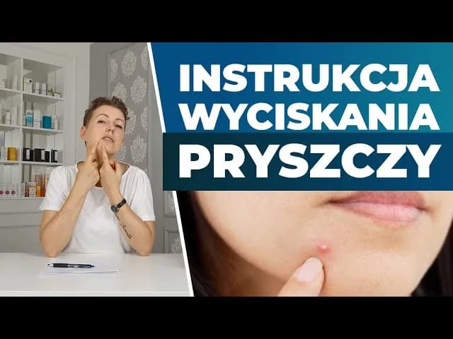 Co jest w środku pryszcza? Zaskakujące fakty o jego zawartości
