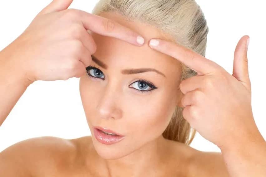 Jak stosować maść ichtiolową na pryszcze, aby uniknąć blizn