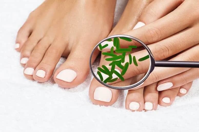 Zielona bakteria na paznokciu – objawy, przyczyny i skuteczne metody leczenia
