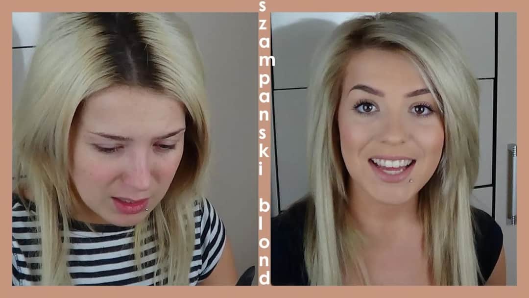 Jak skutecznie usunąć żółte odrosty i zapobiec ich powstawaniu – praktyczne porady